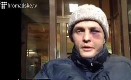Игорь Луценко рассказал, как его били и спрашивали о Майдане (видео)