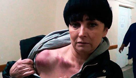В Донецке пытались задушить журналистку &quot;Дорожного контроля&quot;