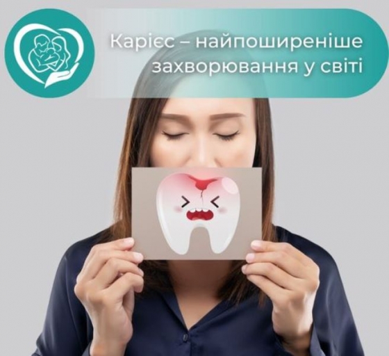 Що таке карієс і як його запобігти: рекомендації лікарів Центру сімейної медицини №1 Краматорська