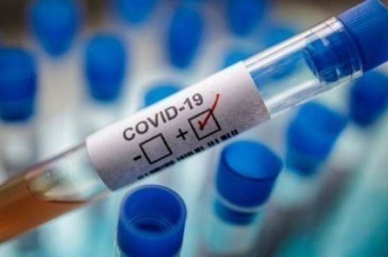 Оперативная информация по Краматорску относительно заболеваемости COVID-19: +7 случаев