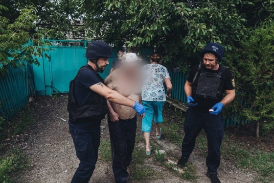 У трьох містах Донеччини госпіталізовано до лікарень 16 осіб, поранених внаслідок ворожих обстрілів, - ДСНС