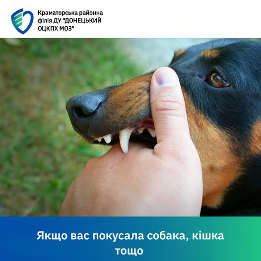 Що необхідно робити і куди звертатися краматорцям, якщо покусала тварина