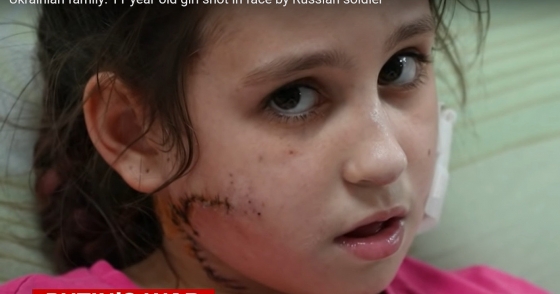 В Мариуполе российский захватчик выстрелил в лицо 11-летней девочке