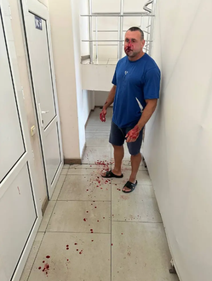 Облаяв захисника і побажав смерті. В Одесі сплахнув новий скандал: деталі інциденту