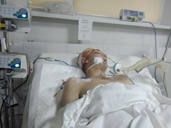 Краматорцю, постраждалому внаслідок вибуху у гуртожитку, потрібна допомога на лікування