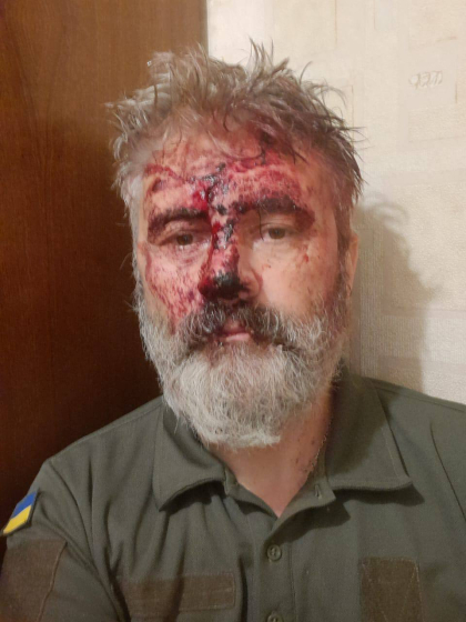 Біля Михайлівського собору напали на митрополита Климента, який є військовослужбовцем ЗСУ. Нацполіція встановлює обставини події (фото)