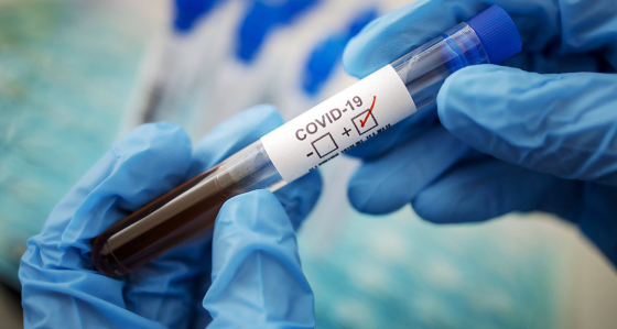 У Краматорську від COVID-19 померла літня людина