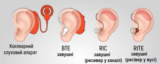 Завушні слухові апарати: особливості, види