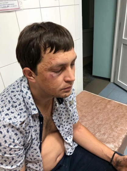 Полиция Славянска расследует избиение активиста в Николаевке 