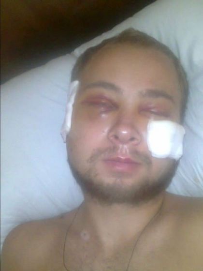 Максим Ильченкочерез 2 недели после ранения