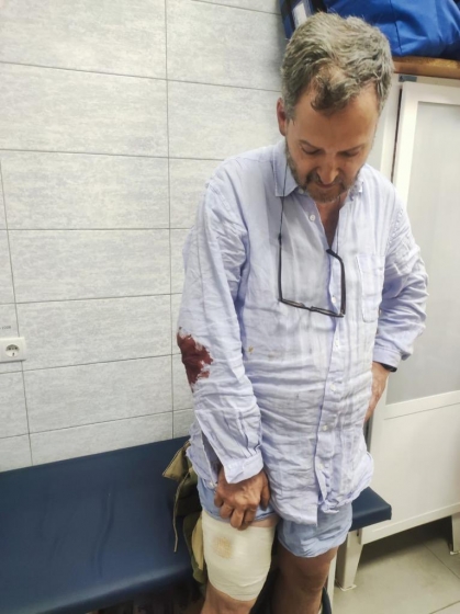 Серед поранених внаслідок ракетного удару по Краматорську - українська письменниця Амеліна і троє громадян Колумбії (фото)