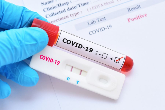 У Краматорську зростає захворюваність на COVID-19