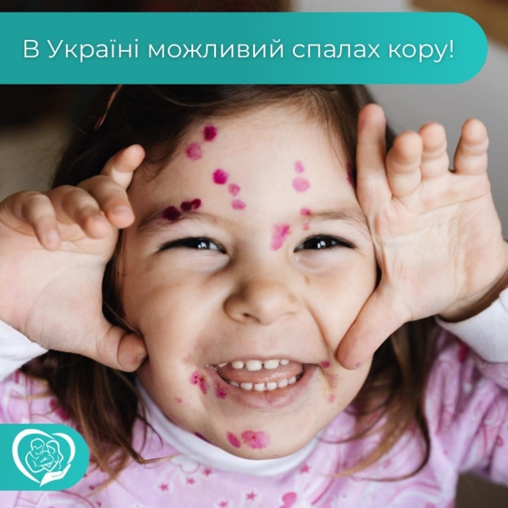 Єдиний захист від кору — вакцинація! Звертайтеся до Центру сімейної медицини №1!