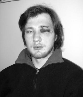 Журналиста в Краматорске избили в уличной драке, и профессиональная деятельность ни при чем – Солодун (дополнено)