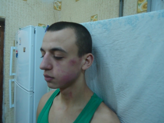 В Краматорске милиционеры пытали студента? (фото)
