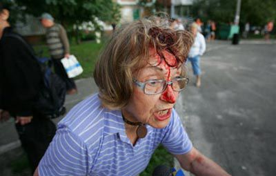 В Киеве охраники строительства торгового центра в кровь избили протестующих горожан (фото)